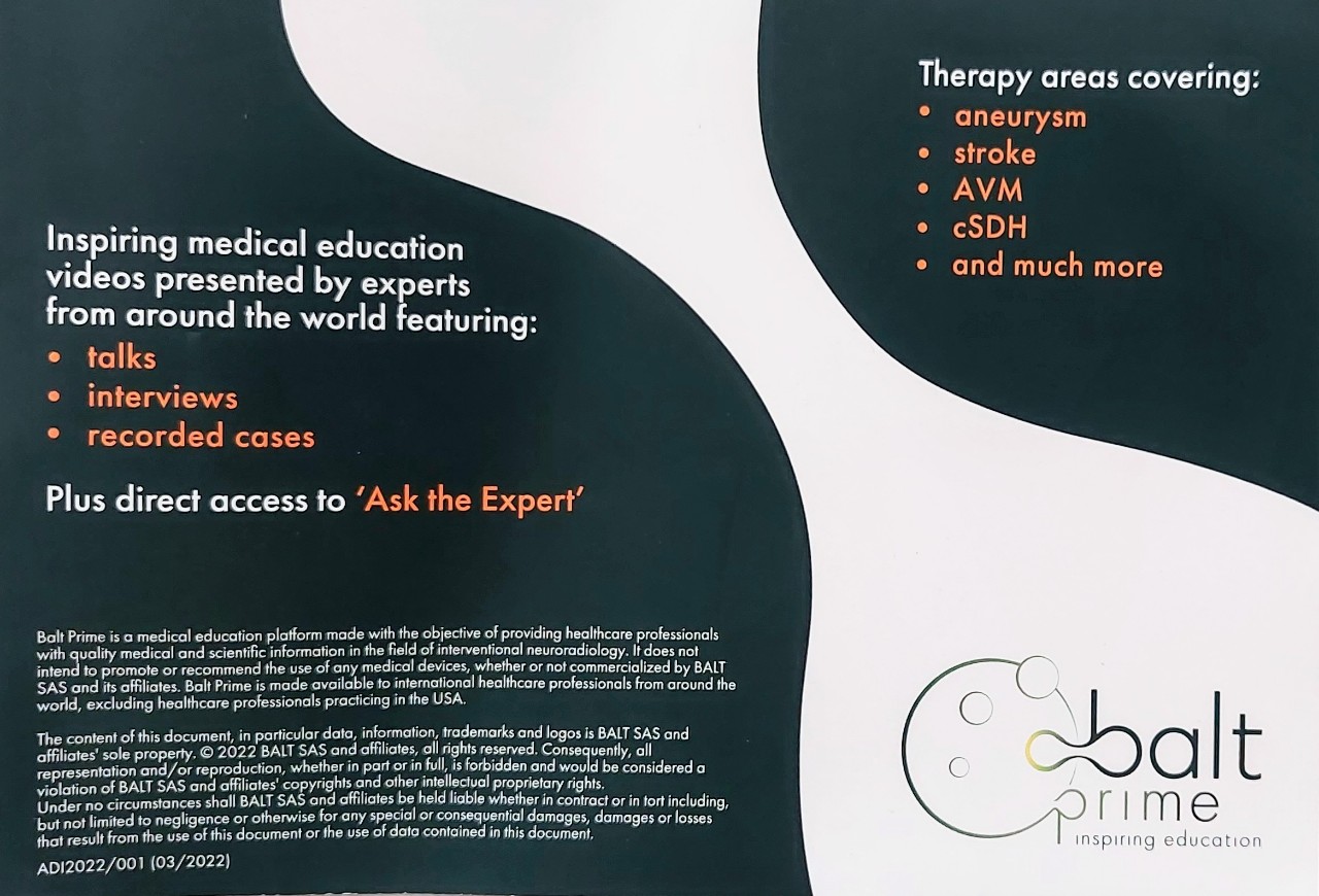 ĐIỀU TRỊ PHÌNH FUSIFORM BÓC TÁCH ĐOẠN MCA BẰNG STENT CHUYỂN HƯỚNG DÒNG CHẢY SILK+/SILK VISTA.