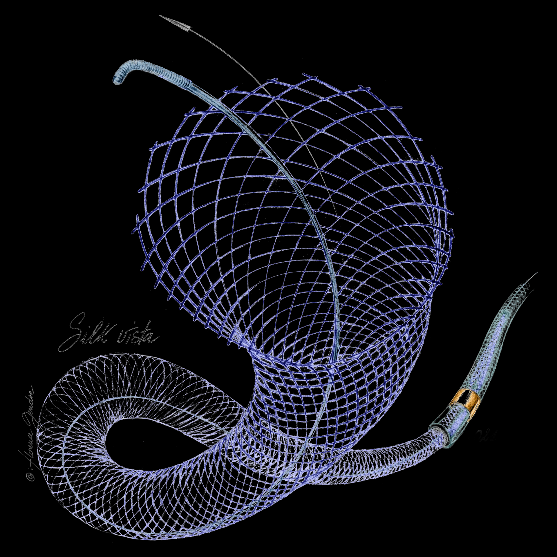 SILK VISTA STENT ĐIỀU CHỈNH DÒNG CHẢY