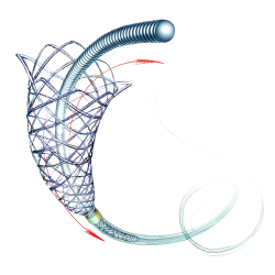 LEO+ Khung giá đỡ mạch máu não